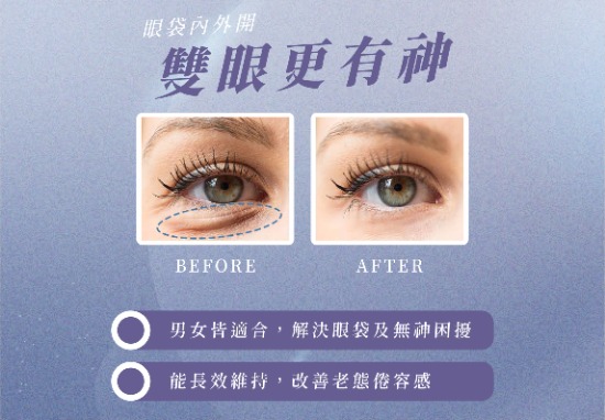 眼袋內外開